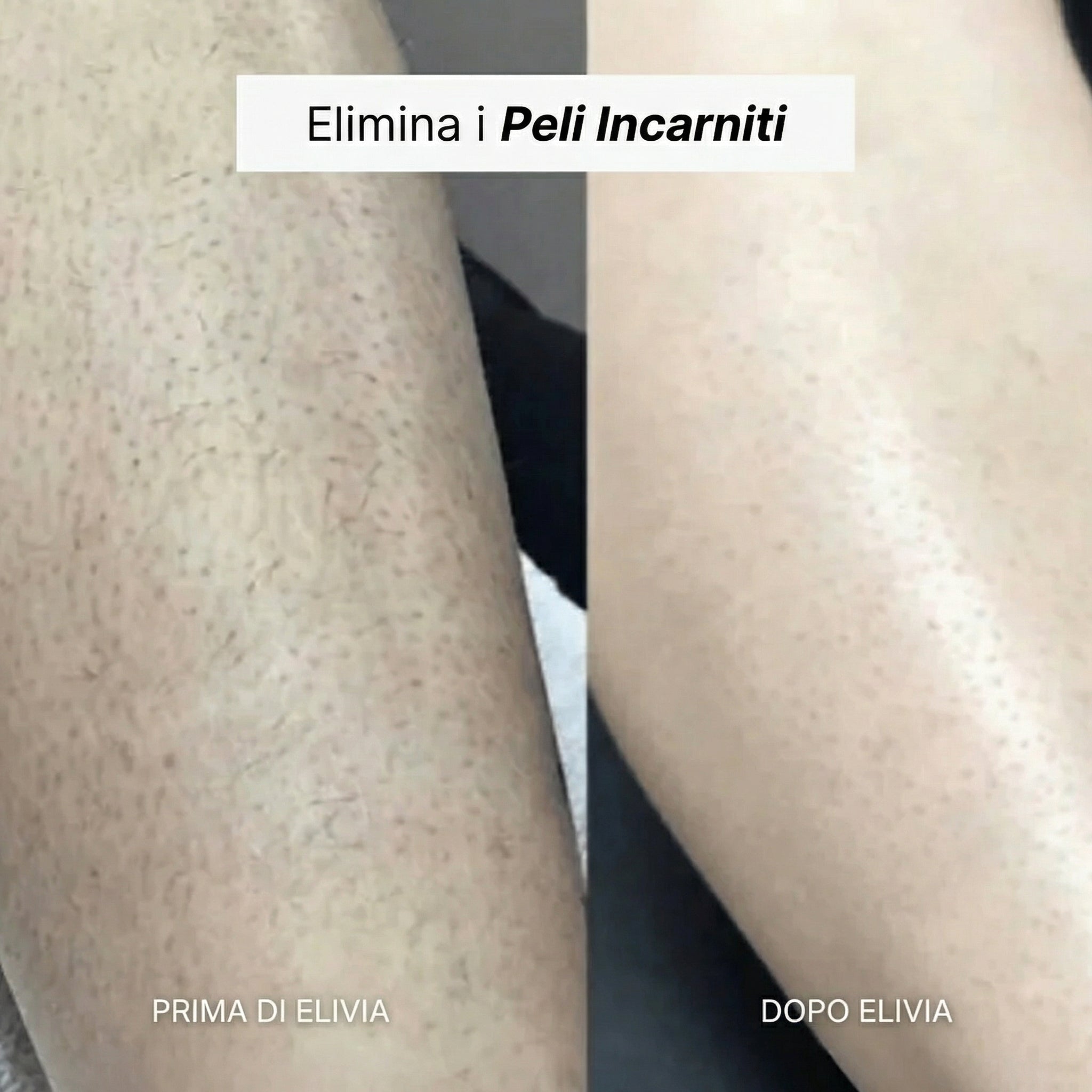 Elivia - Rasoio 5-in-1