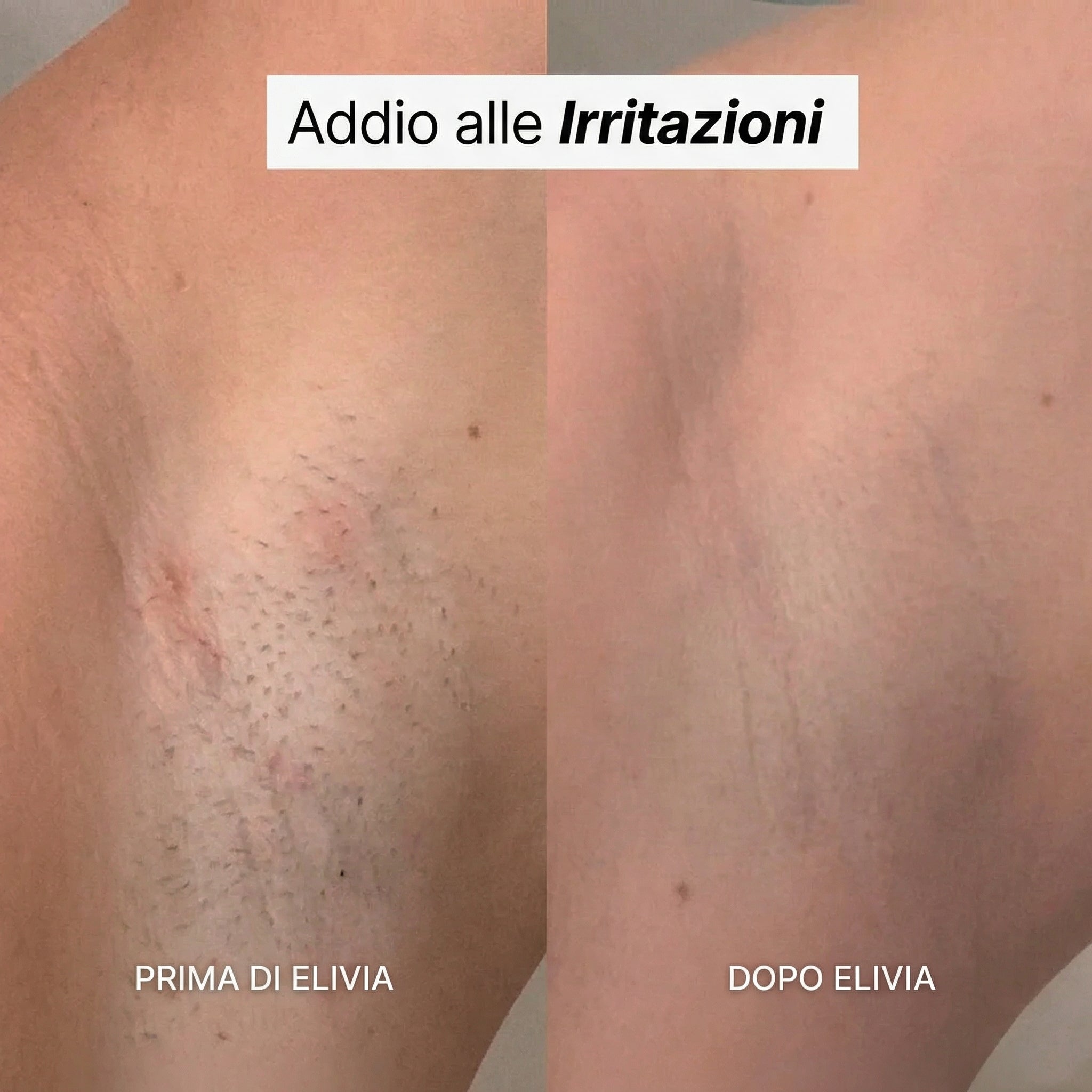 Elivia - Rasoio 5-in-1